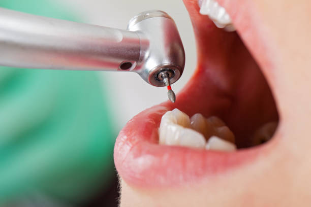 Best After-Hours Emergency Dentist in Potterville, MI